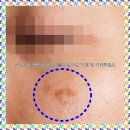 명성세탁 | 안산피코토닝 깨끗한 피부 만들고 싶다면 ‘이것’만 기억하세요