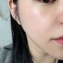 셀코패키지 | 모공 줄이는법 찾다 써본 블라쥬 셀뷰린 에센스｜코모공 모공관리 화장품 후기