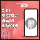 세정치과의원 | 용인 치과 치아 충치 보철 치료 뜻과 종류 각각의 평균적인 비용은?
