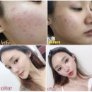 SHJ뷰티케어 | [나요밍마켓] 1월 첫째주~셋째주 확정된 공구일정안내 & 12월 후기왕이벤트 당첨자발표♥