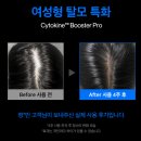 병권 | 탈모예방,관리템! 리필드 헤어토닉 내돈내산｜잭클린 할인 링크로 구매!
