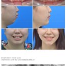 스마일어게인치과교정과치과의원 이미지