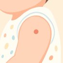 양천탑의원 | BCG 피내용 신생아 예방접종 후 고름관리 가격 흉터