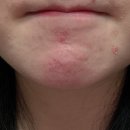 버블헤드 | 지성피부 블랙헤드 관리 버블 앰플 클렌저 사용후기 !