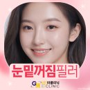 터치미의원 | 눈밑꺼짐필러후기 유지기간 추천 비교