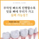 함평치과의원 | 광산구치과 임플란트 치료 기간 오래 걸리는 이유