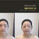 라즈뮤에스테틱