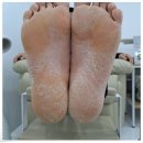 닥터아이티엔네일쿱스 | 대전발각질 말끔하게 해결! 네일쿱스 닥터아이티엔 대전대덕구점