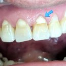 상아치과재료 이미지