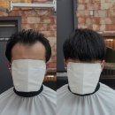 양천구 목동 40대 남성 M자 앞머리 갈라짐 탈모 펌 시술 후기(스핀스왈로펌 아님)