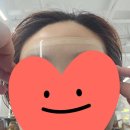 진영읍보건지소 | 진영 미용실 골드핸즈 헤어살롱 김해진영점 염색후기