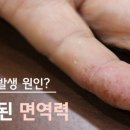 몸에 한번 생기기 시작하면 정말 골치 아프고 신경 쓰이는 것.jpg(사진주의) 이미지