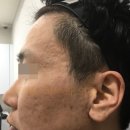 셀렉트피부과의원 네이버블로그