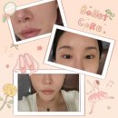 순환한의원 | [강남역/한의원] 얼굴 제네시스 토닝 + 기혈순환 침 후기 – 피부 톤과 컨디션을 함께 정돈한 하루 🌿🪡✨