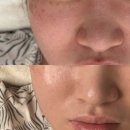 화신로8길1-14 | 평택윤곽관리 로즈아트스킨 평택피부관리 평택웨딩관리 문제성피부 이지솔 솔직 후기