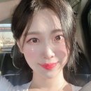 예스미의원 | 강남 울쎄라 300샷 가격 리프팅 한달 후기 사진(세이예스의원)