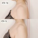 (유)하마 | [인천 십정동] 부평 에스테틱 윤곽&amp;체형관리 후기 &#39;유리햅에스떼&#39;