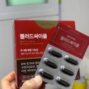 지방간의 진단과 관리 | 중성지방 정상수치 스스로 관리한 후기