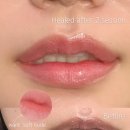 일상 | 대구입술반영구 립밤만 발라도 예뻐지는 세이지뷰티 일상 후기