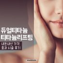 듀얼티타늄 티타늄리프팅 내돈내산 가격 효과 시술 후기
