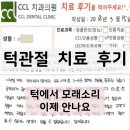 턱관절 치료 후기, 턱에서 모래소리 이제 안나요!