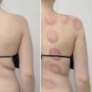 아델라인뷰티 | 검단신도시 피부 윤곽관리 :: 아델라인 뷰티 바디테라피 관리후기