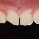 테크노파크역1-1 이미지