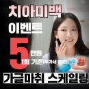 1미리 | 부천 1미리치과 치아미백 후기 내돈내산