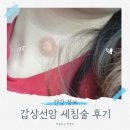 어리광 | 30대 갑상선암 검사 후기 및 방법 (갑상선 결절 크기/세침검사)