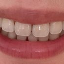 메디케어치과의원 | 공덕역 서울메디케어의원에서 건강검진 받고 건강 챙기기^.^ (검진항목, 인생 첫 위내시경, 비용 등)