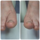 레푸스 감삼점&에이레네 이미지