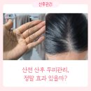 산후 탈모 시기 언제까지? 두피관리샵에서 케어 받았던 후기
