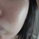 대한의원 | 대기 어마어마한 대구 피부과 예수의원 주사피부염 진료 후기