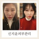 홍대에스테틱 윤곽관리 홍대신지윤피부관리