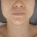 나루상가 반송동 피부관리 잘하는곳 수앤미에스테틱 써멀리프팅 후기