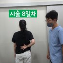 진접정형외과의원 | 반복적으로 재발하는 오십견 - 목과 어깨 통증은 비관혈적 수동술로 마무리할 수 있습니다
