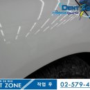 덴트존 이미지