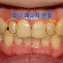 더굿모닝치과의원 네이버블로그