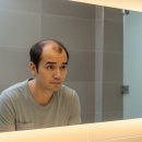 클라스코인 | 클라스코테론(Clascoterone), 성기능 부작용 없는 '바르는 탈모약'의 등장! 효과와 출시일 완벽 정리