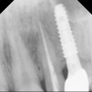 차플란트치과의원 이미지