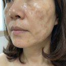 밝은호수약국 | 도미나크림 6개월이나 써본 50대 솔직후기