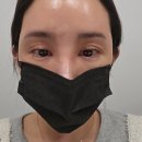 논현2-122 | [강남/왁싱삼공 논현점] 인중왁싱 후기✨ 여성전용 샵 &amp; 전문관리사 케어💗