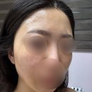 안산 상록수역 피부관리 에스테틱 [민뷰티]