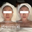선996 | [에스테틱🧚🏻‍♀️ #4] 선에스테스파 수원점 (예비신부 윤곽관리 추천👍🏻)