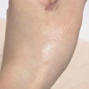 웃는약국 | 탈모 예방 외 직구템들 내돈내산 후기 (호베랩스 / 트레제메 / 코바야시 / 케프스프레이 등 )