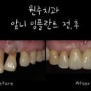 좋은이웃치과의원 이미지