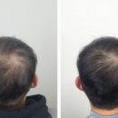 하프톤 스칼프 이미지