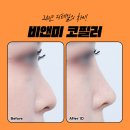 송도비앤미의원 | 인천 연수구 인천대입구 송도비앤미 코필러 잘하는곳