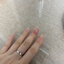 신사드림약국 | 봉와직염(조갑주위염) 수술 후 회복기. . . 그리고 삼성화재 실비 보험금 청구 후기
