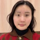 라인필의원 | 수원 인계동 리프팅 추천 세모아의원 티타늄리프팅 슬림핏윤곽주사 솔직후기